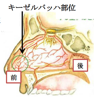 鼻血